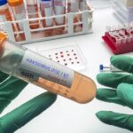 Imagen de un laboratorio de salud pública trabajando en una prueba PCR para detectar hantavirus