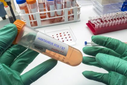 Imagen de un laboratorio de salud pública trabajando en una prueba PCR para detectar hantavirus