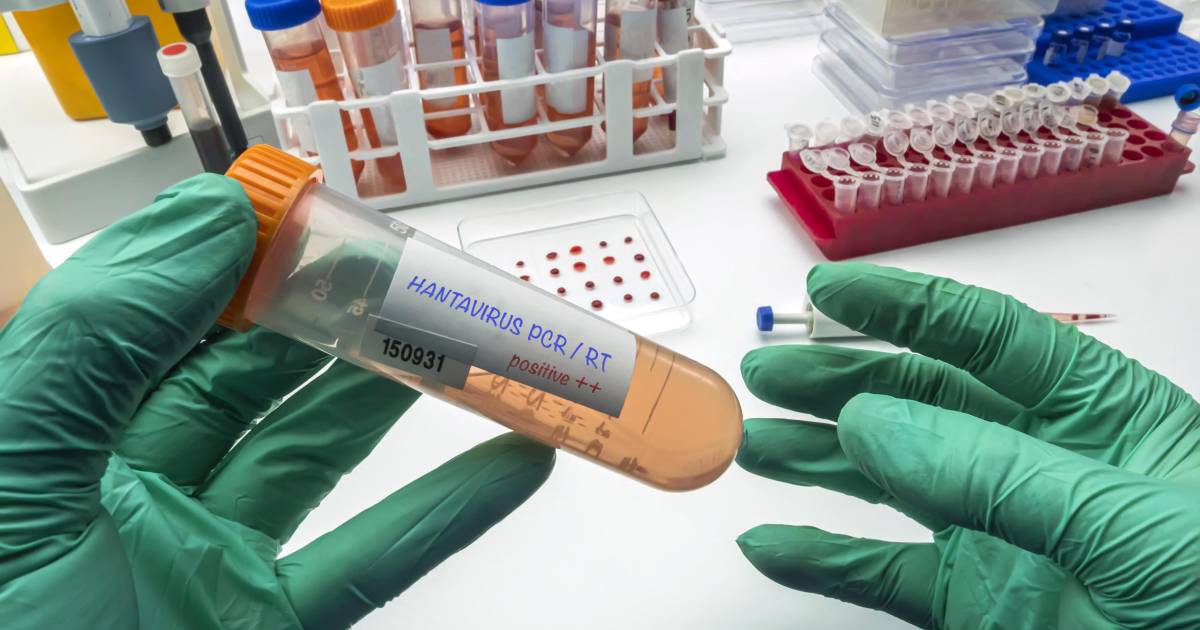 Imagen de un laboratorio de salud pública trabajando en una prueba PCR para detectar hantavirus