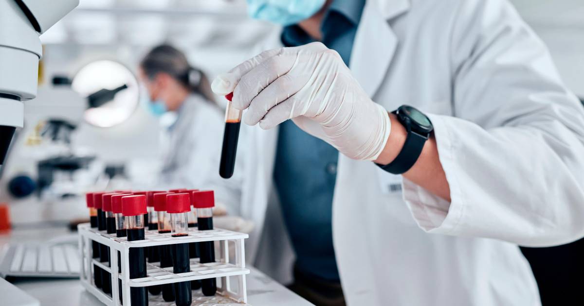 Imagen de una tira reactiva para test de sangre con un fondo de laboratorio.